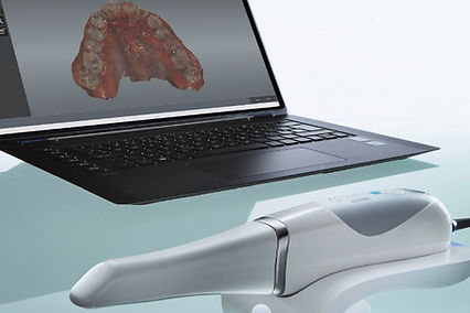 SCANNER INTRAORAL.jpg
