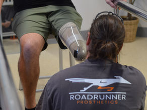 Prosthetists Mac fitting new Prosthesis, Check Socket