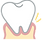 歯のぐらつき