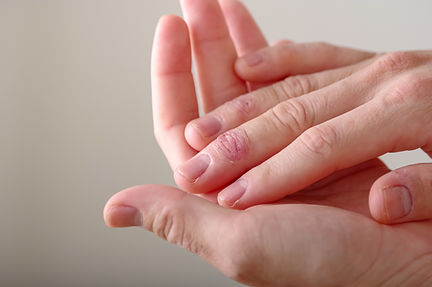 外傷や皮膚疾患など