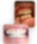 charlies before and after photo of full dental treatment at ultradent dental clinic, tbilisi georgia