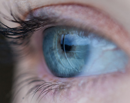 Cornea Transplant