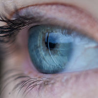 Cornea Transplant
