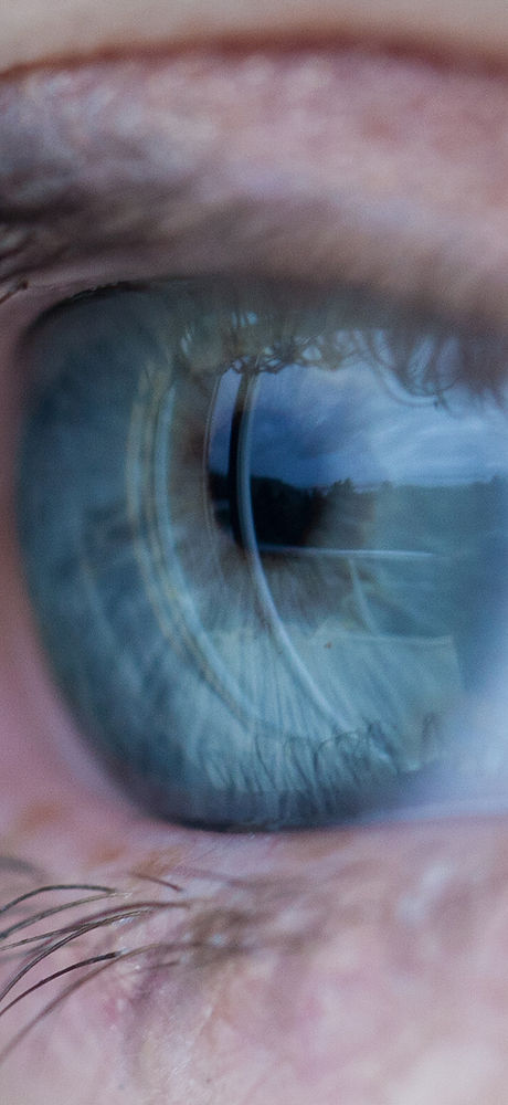 Cornea Transplant