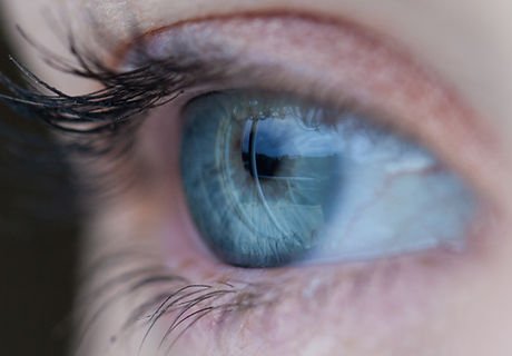 Cornea Transplant