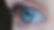Cornea Transplant