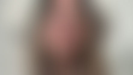 Dietoterapia w chorobie Hashimoto 