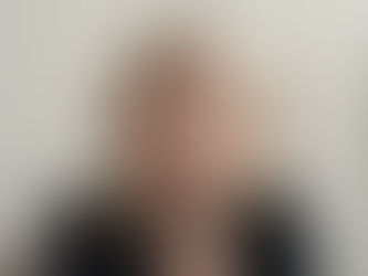 Oś jelito–skóra w praktyce klinicznej: przypadek pacjentki z AZS, SIBO i nadwrażliwościami pokarmowymi