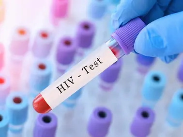 HIV-Blood-Test-scaled-1.jpg.webp
