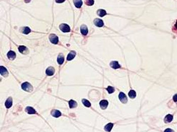 Spermocytogramme 2.jpg