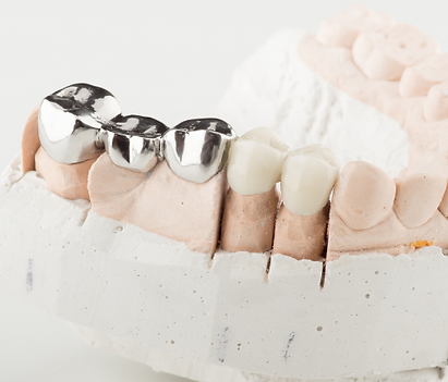 Studio dentistico moderno con attrezzatura digitale per implantologia - GLP Dentale
