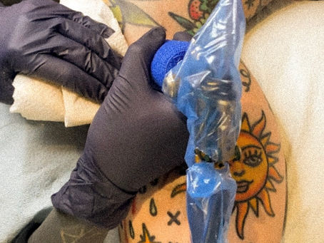 Est-il possible de se faire tatouer sur une cicatrice?