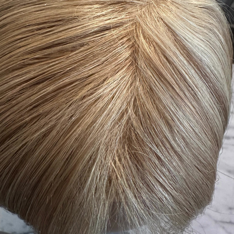 Thumbnail: CPL11042177- Cranial Prosthesis Light