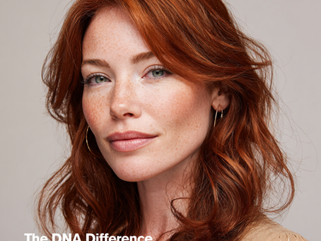 The DNA Difference 🧬 How Genetic Science Transformed One Client's 23-Year Hair Loss Journey