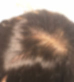 Thumbnail: CORPORATE COLLECTION: Virgin Hair Readymade HD Cranial Prosthesis Regular: (CPR)