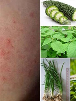 Cách trị rôm sảy ở trẻ sơ sinh