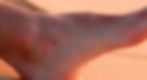 ree
