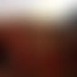 A decisão da Prefeitura de Porto Velho de romper o contrato com o consórcio EcoPVH marca mais um capítulo de uma crise que se arrasta há meses e que transformou a coleta de lixo no principal desafio administrativo da atual gestão