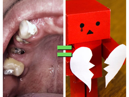 Did you know that people with bad oral health get heartbroken more?