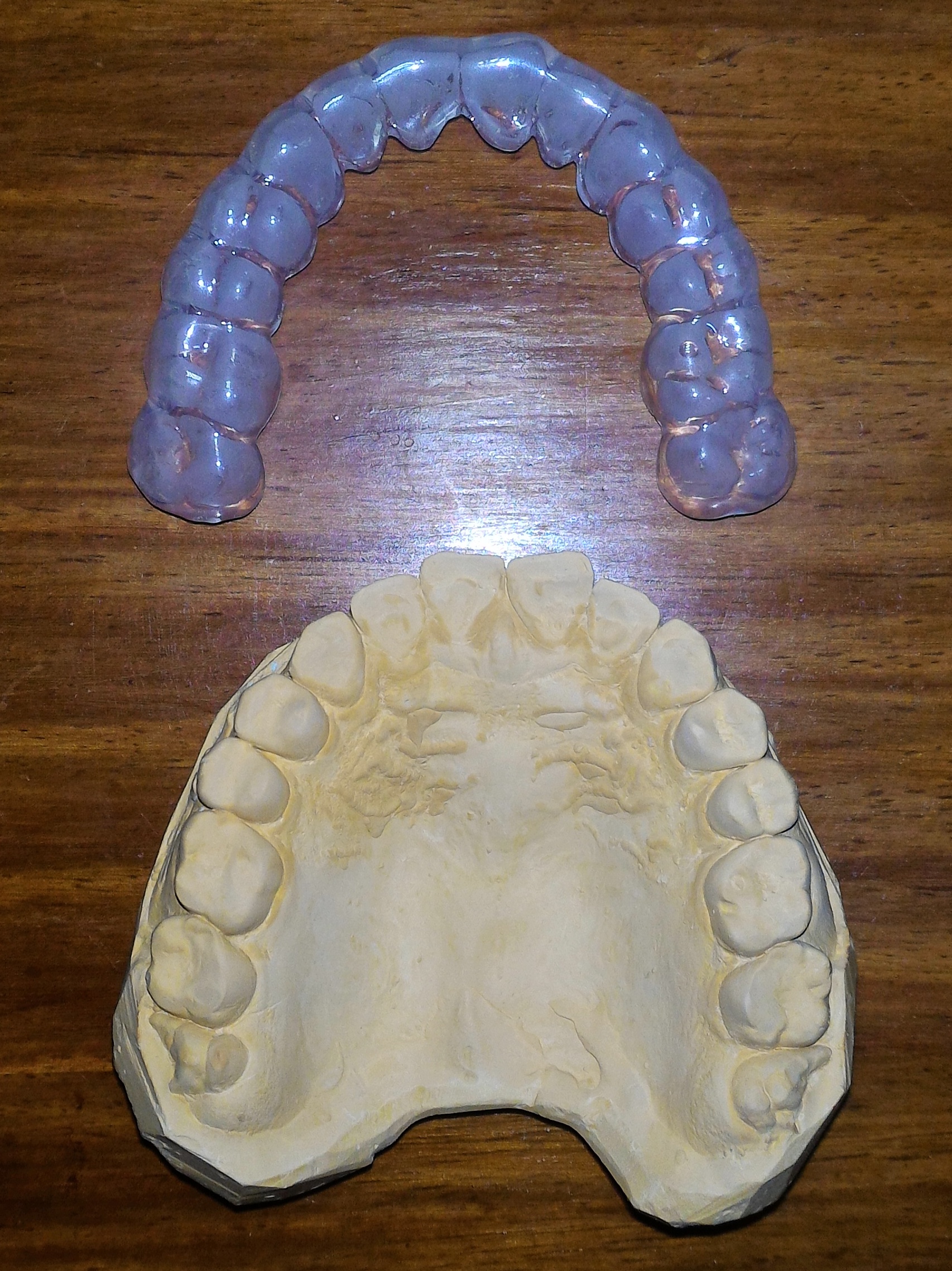 soft mouthguard for nightgrinding