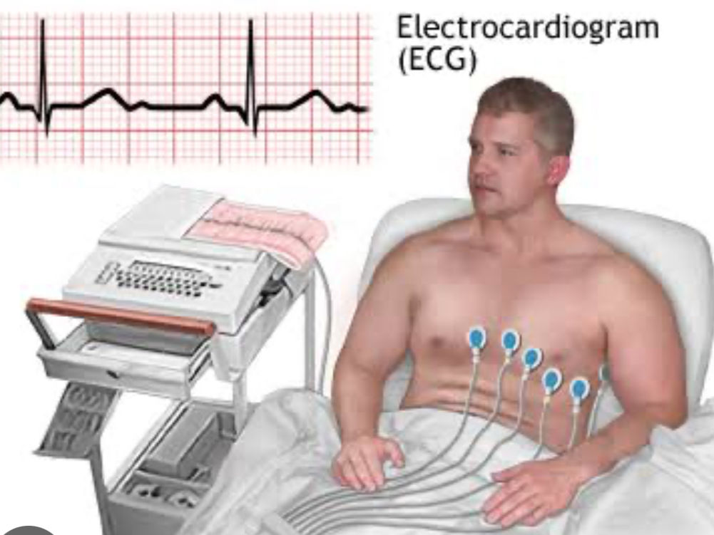 Electrocardiogram (ECG) test showing heart rhythm