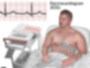 Electrocardiogram (ECG) test showing heart rhythm