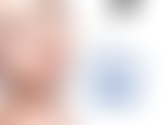 O que é ácido lactobiônico?