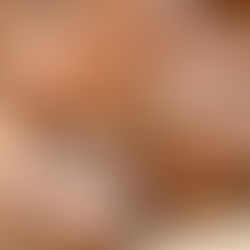 Dieta Carnívora: Risco Real ou Exagero? O Que a Ciência Diz Sobre Colesterol