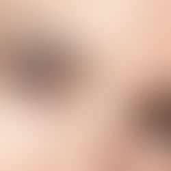 Flacidez facial: por que acontece e o que realmente melhora