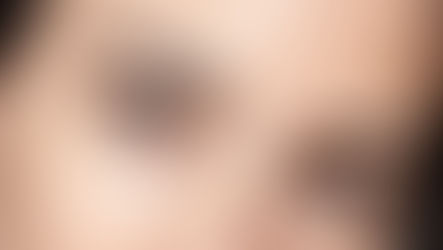 Flacidez facial: por que acontece e o que realmente melhora