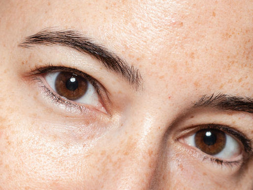 Flacidez facial: por que acontece e o que realmente melhora