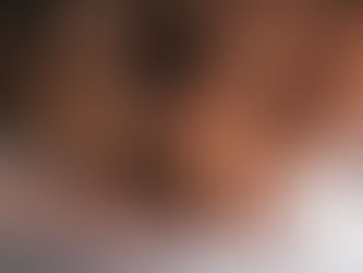 Pontas duplas: por que surgem, por que não se reparam — e como evitar que avancem