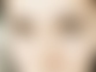 Qual corretivo escolher para disfarçar muita olheira?