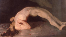 Vacinas (V): difteria, tétano e coqueluche
