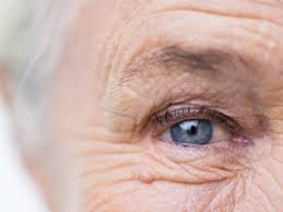 arrugas-elixir-medics