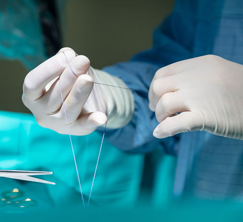 Gallenblasenstein Schilddrüse Cholezystektomie Minimalinvasive Operation Laparoskopie Hild