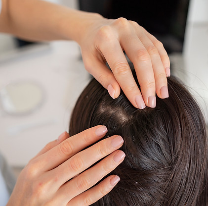 close-up-doctor-treating-dandruff.jpg