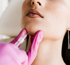 a woman with chin filler