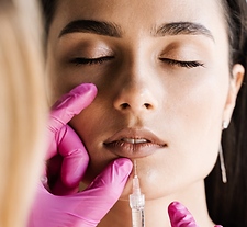 a woman with lip filler
