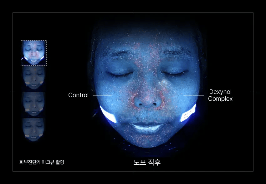 Thumbnail: 5-minute Acne-Line Solution