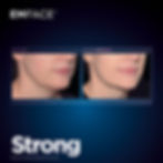 Emface Results Jawline