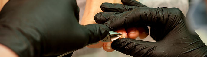 Knippen van teennagels