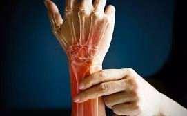 Cirurgia da Mão e a Curva de Carpo: Um Olhar Detalhado