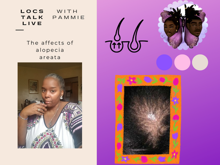 Alopecia Areata
