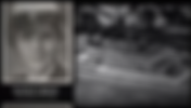 "JFK Revisited" Misleads on the Autopsy Photographs of JFK, Part Two