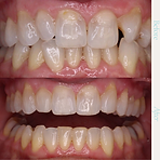 Before and After Instagram Post (1).png