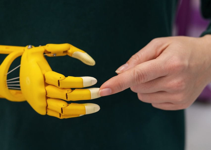 Amputation prosthetic technology