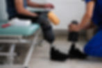 What Is an Amputation Injury?