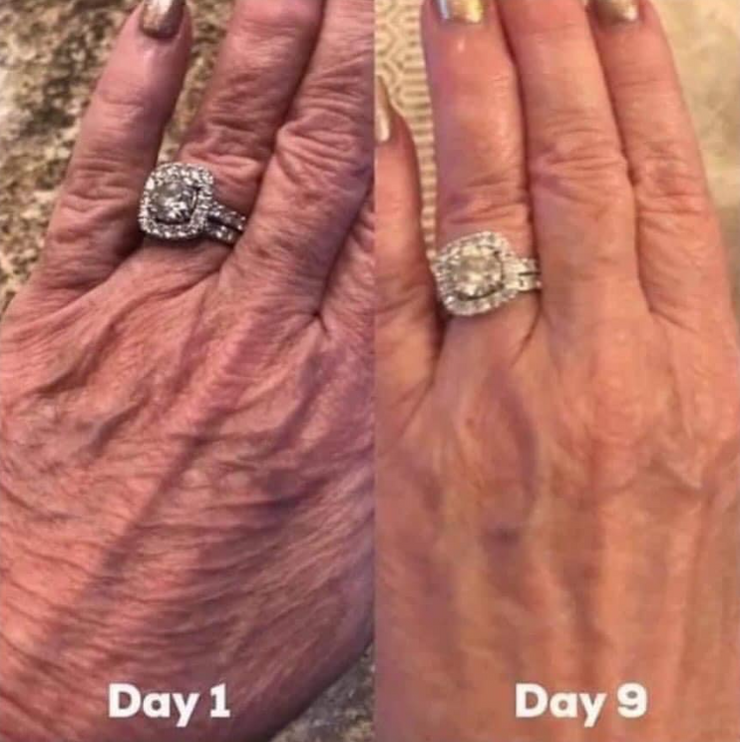 Before and after image of using Isagenix Collagen Elixir