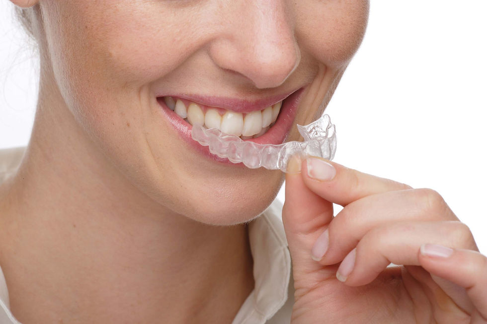 invisible-braces1